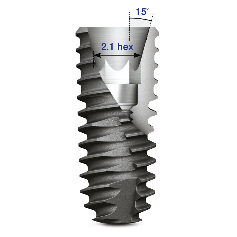 ks-3-implant.jpg