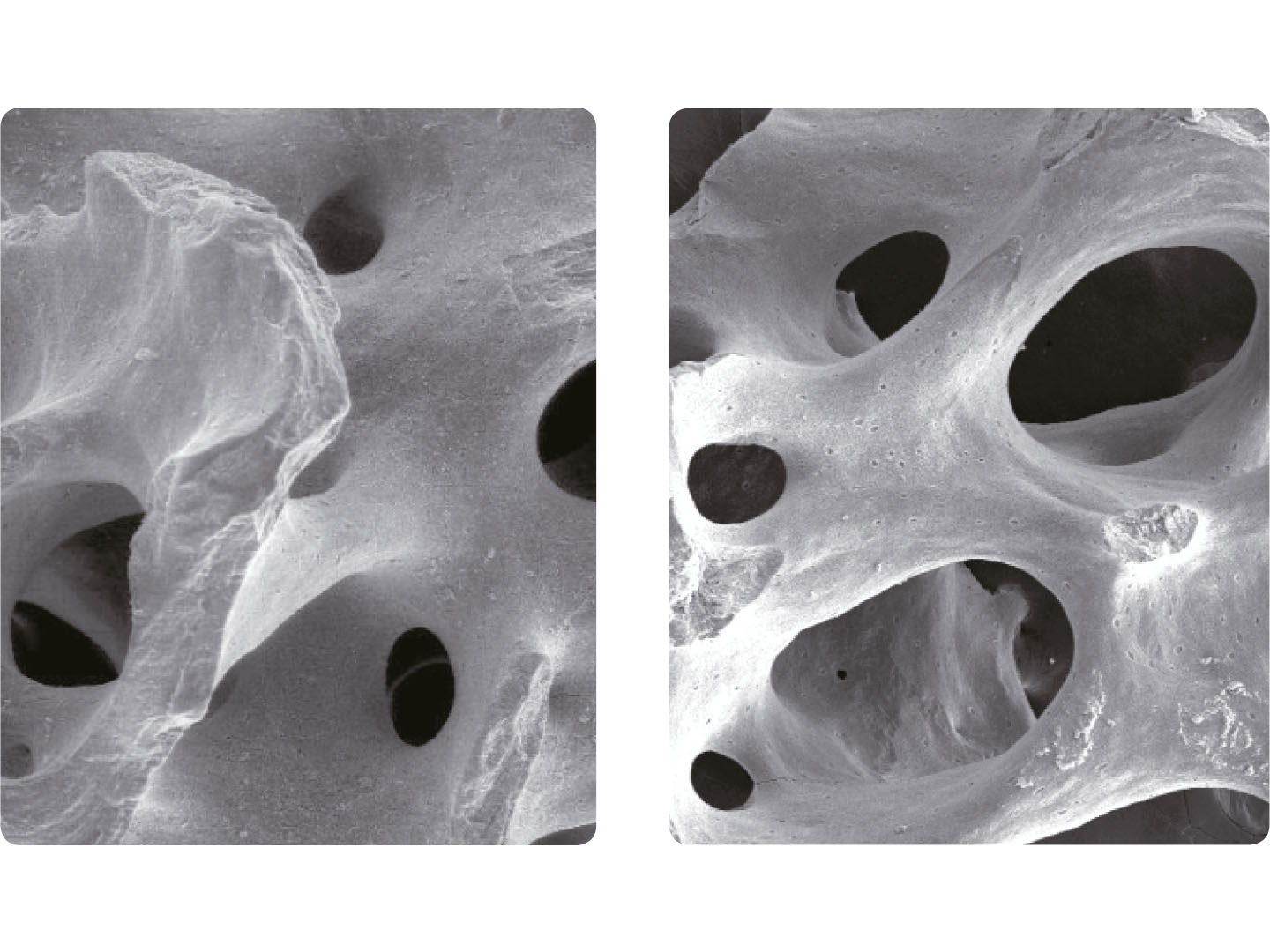 pore-structure-a-oss.jpg